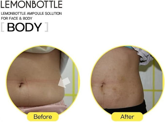 Лимонная бутылка Липолаб Липолиз похудеть похудеть лимонная бутылка